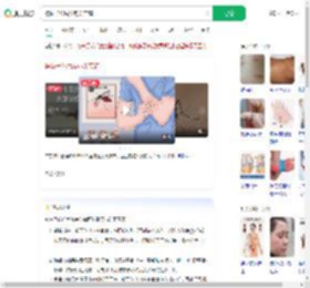 被蚊子咬后发热关节痛_360搜索