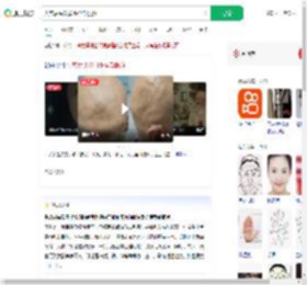 失恋后头发眉毛全部脱落_360搜索